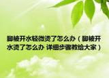 腳被開水輕微燙了怎么辦（腳被開水燙了怎么辦 詳細步驟教給大家）