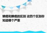 鱗癌和腺癌的區(qū)別 這四個(gè)區(qū)別你知道哪個(gè)嚴(yán)重