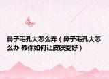 鼻子毛孔大怎么弄（鼻子毛孔大怎么辦 教你如何讓皮膚變好）