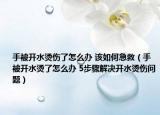 手被開水燙傷了怎么辦 該如何急救（手被開水燙了怎么辦 5步驟解決開水燙傷問題）