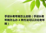 手背長(zhǎng)老年斑怎么去除（手背長(zhǎng)老年斑怎么辦 4 種方法可以淡化老年斑）