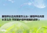 腳指甲長在肉里面怎么治（腳指甲往肉里長怎么辦 平時愛護指甲周圍的皮膚）