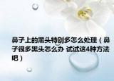 鼻子上的黑頭特別多怎么處理（鼻子很多黑頭怎么辦 試試這4種方法吧）