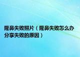 隆鼻失敗照片（隆鼻失敗怎么辦 分享失敗的原因）