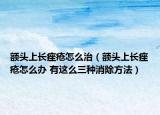 額頭上長痤瘡怎么治（額頭上長痤瘡怎么辦 有這么三種消除方法）