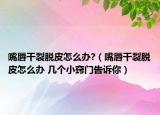 嘴唇干裂脫皮怎么辦?（嘴唇干裂脫皮怎么辦 幾個小竅門告訴你）