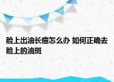 臉上出油長痘怎么辦 如何正確去臉上的油斑