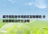 扁平疣和老年斑的區(qū)別有哪些 分別有哪些治療方法呢