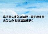 鼻子黑頭多怎么清理（鼻子很多黑頭怎么辦 徹底清潔皮膚）