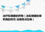 治療蛇纏腰的藥物（治蛇纏腰的草藥做的藥膏 這病有點(diǎn)恐怖）