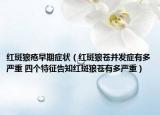 紅斑狼瘡早期癥狀（紅斑狼蒼并發(fā)癥有多嚴(yán)重 四個特征告知紅斑狼蒼有多嚴(yán)重）