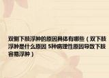 雙側(cè)下肢浮腫的原因具體有哪些（雙下肢浮腫是什么原因 5種病理性原因?qū)е孪轮菀赘∧[）