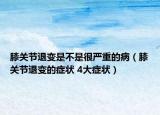膝關(guān)節(jié)退變是不是很嚴(yán)重的?。ㄏリP(guān)節(jié)退變的癥狀 4大癥狀）