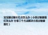 寶寶腳過敏長紅點怎么辦（小孩過敏腳面紅怎么辦 分享三個方法解決小孩過敏腳面紅）