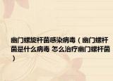 幽門螺旋桿菌感染病毒（幽門螺桿菌是什么病毒 怎么治療幽門螺桿菌）