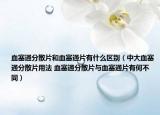 血塞通分散片和血塞通片有什么區(qū)別（中大血塞通分散片用法 血塞通分散片與血塞通片有何不同）
