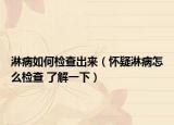 淋病如何檢查出來（懷疑淋病怎么檢查 了解一下）