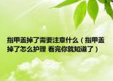 指甲蓋掉了需要注意什么（指甲蓋掉了怎么護(hù)理 看完你就知道了）