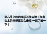 嬰兒頭上的啾啾屎怎樣去掉（寶寶頭上的啾啾屎怎么去掉 一起了解一下）