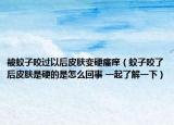 被蚊子咬過以后皮膚變硬瘙癢（蚊子咬了后皮膚是硬的是怎么回事 一起了解一下）