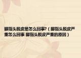 腳指頭脫皮是怎么回事?（腳指頭脫皮嚴(yán)重怎么回事 腳指頭脫皮嚴(yán)重的原因）