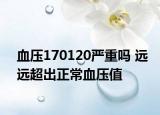 血壓170120嚴(yán)重嗎 遠(yuǎn)遠(yuǎn)超出正常血壓值