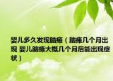 嬰兒多久發(fā)現(xiàn)腦癱（腦癱幾個(gè)月出現(xiàn) 嬰兒腦癱大概幾個(gè)月后能出現(xiàn)癥狀）