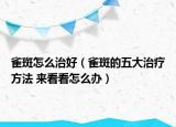 雀斑怎么治好（雀斑的五大治療方法 來看看怎么辦）