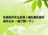 乳根裂開(kāi)怎么處理（哺乳期乳根開(kāi)裂怎么辦 一起了解一下）