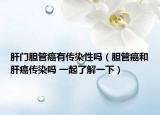 肝門膽管癌有傳染性嗎（膽管癌和肝癌傳染嗎 一起了解一下）