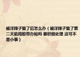 被洋辣子蟄了后怎么辦（被洋辣子蟄了第二天能用膠帶辦粘嗎 要積極處理 這可不是小事）