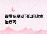銀屑病早期可以用激素治療嗎