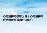 心電監(jiān)護電極怎么貼（心電監(jiān)護電極貼放位置 醫(yī)學小常識）
