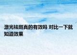 激光祛斑真的有效嗎 對比一下就知道效果