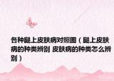 各種腿上皮膚病對(duì)照?qǐng)D（腿上皮膚病的種類辨別 皮膚病的種類怎么辨別）