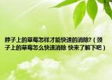脖子上的草莓怎樣才能快速的消除?（頸子上的草莓怎么快速消除 快來了解下吧）