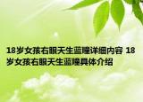 18歲女孩右眼天生藍(lán)瞳詳細(xì)內(nèi)容 18歲女孩右眼天生藍(lán)瞳具體介紹