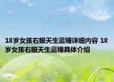 18歲女孩右眼天生藍(lán)瞳詳細(xì)內(nèi)容 18歲女孩右眼天生藍(lán)瞳具體介紹