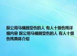 踩公用馬桶圈受傷的人 有人十級(jí)傷殘?jiān)敿?xì)內(nèi)容 踩公用馬桶圈受傷的人 有人十級(jí)傷殘具體介紹