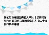 踩公用馬桶圈受傷的人 有人十級(jí)傷殘?jiān)敿?xì)內(nèi)容 踩公用馬桶圈受傷的人 有人十級(jí)傷殘具體介紹