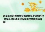 感染新冠后渾身疼專家男性多發(fā)詳細(xì)內(nèi)容 感染新冠后渾身疼專家男性多發(fā)具體介紹