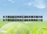 女子感染新冠高燒后滿臉發(fā)黑詳細(xì)內(nèi)容 女子感染新冠高燒后滿臉發(fā)黑具體介紹