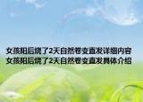 女孩陽后燒了2天自然卷變直發(fā)詳細內(nèi)容 女孩陽后燒了2天自然卷變直發(fā)具體介紹