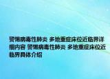 警惕病毒性肺炎 多地重癥床位近臨界詳細內(nèi)容 警惕病毒性肺炎 多地重癥床位近臨界具體介紹
