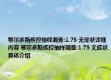 鄂爾多斯疾控抽樣調(diào)查:1.75 無癥狀詳細內(nèi)容 鄂爾多斯疾控抽樣調(diào)查:1.75 無癥狀具體介紹