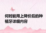 何時(shí)能用上降價(jià)后的種植牙詳細(xì)內(nèi)容