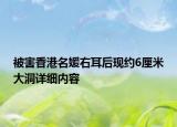 被害香港名媛右耳后現(xiàn)約6厘米大洞詳細(xì)內(nèi)容