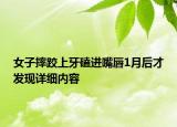 女子摔跤上牙磕進嘴唇1月后才發(fā)現(xiàn)詳細內(nèi)容