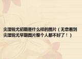 尖濕銳尤初期是什么樣的圖片（無意看到尖濕銳尤早期圖片整個(gè)人都不好了?。? /></span></a>
                        <h2><a href=