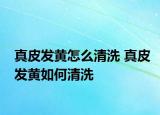 真皮發(fā)黃怎么清洗 真皮發(fā)黃如何清洗
